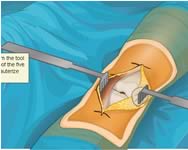 gyessgi - Virtual knee surgery 